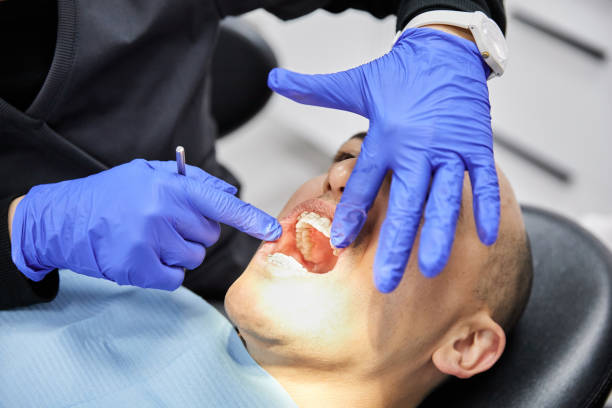 Best Emergency Dental Extractions in Meriden, CT