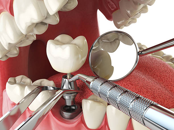 Best Emergency Dental Services for Seniors in Meriden, CT